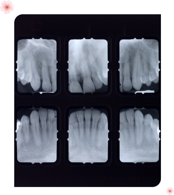 Cherryblossomdentistry (23) Dental X-Ray machine for General Dental Services at Cherry Blossom Dentistry