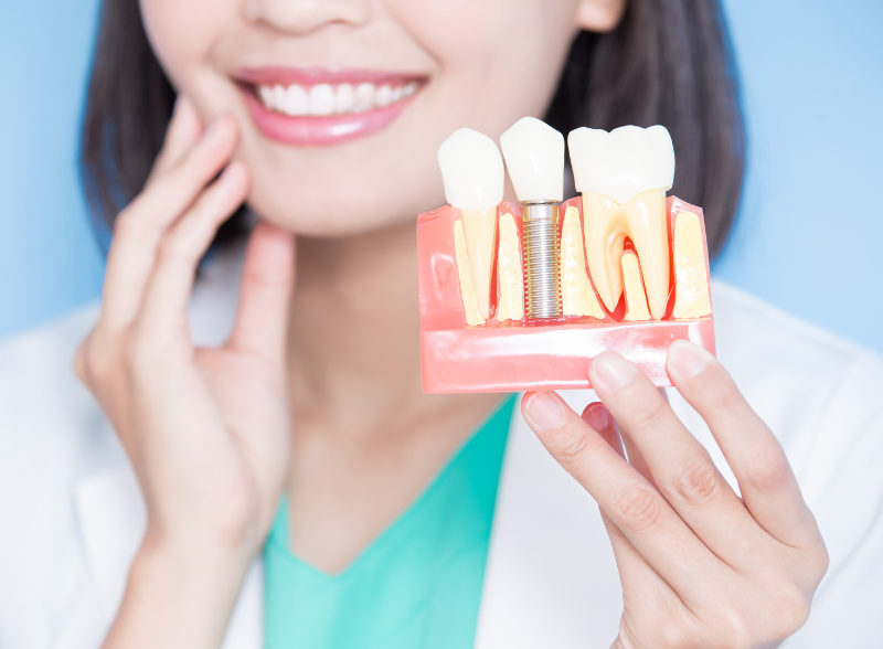 Dental Implants2